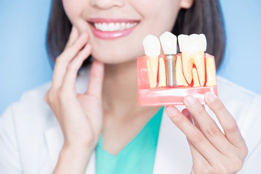 Dentist in North Lake Tahoe shows patient dental implants