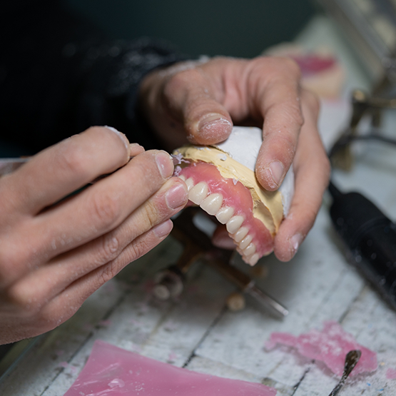 Dental professional creating a denture