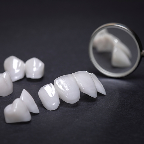 Several veneers on table next to dental mirror