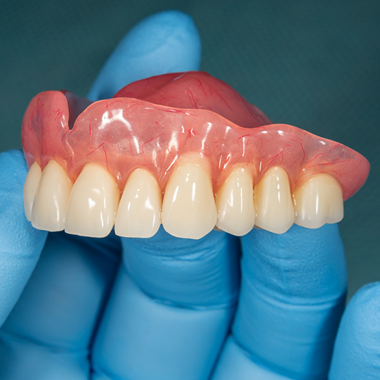 Gloved hand holding a full denture