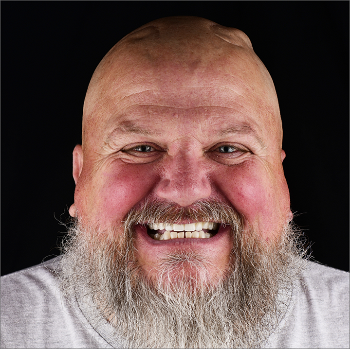 Bearded man smiling with a full set of teeth