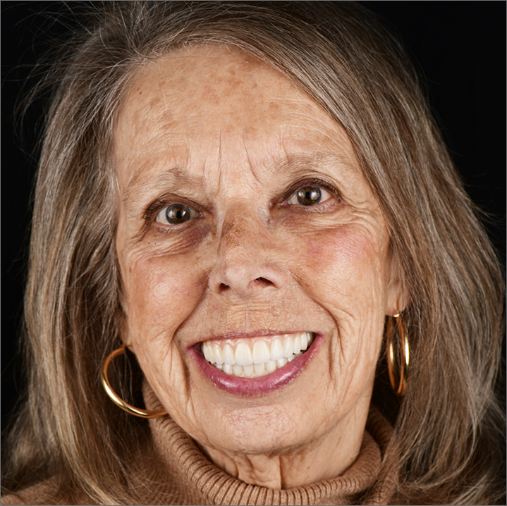 Senior woman smiling with flawless white teeth