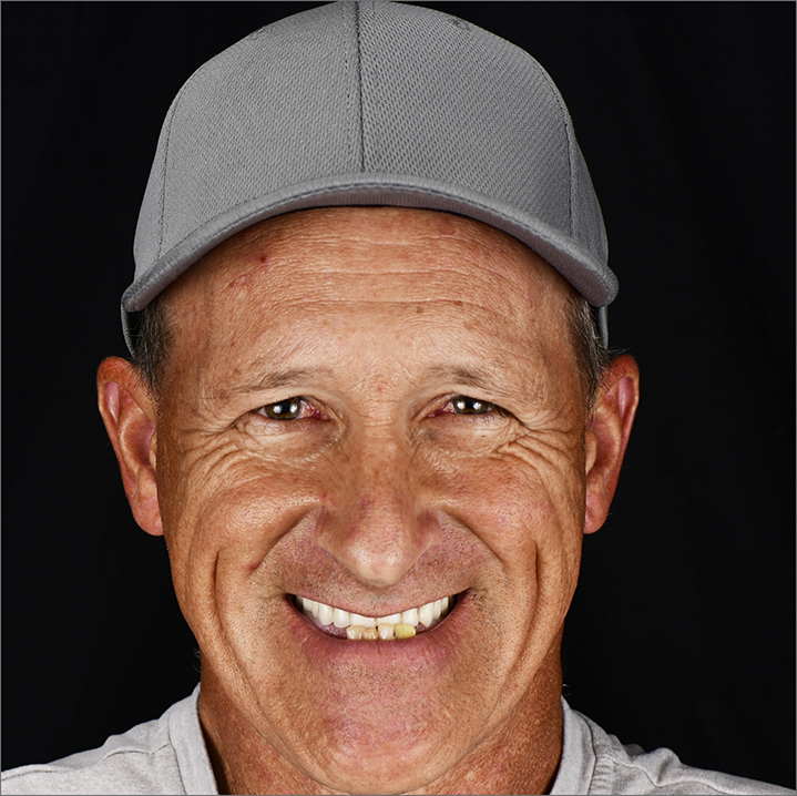 Man grinning with slightly yellowed teeth