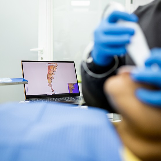 Dental patient having digital impressions taken of their teeth