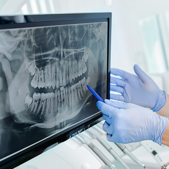 Dentist pointing to computer screen showing x ray of teeth