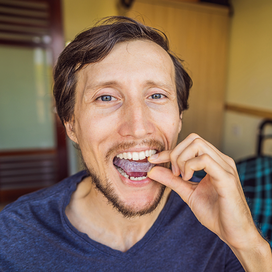 Man placing a mouthguard over his teeth